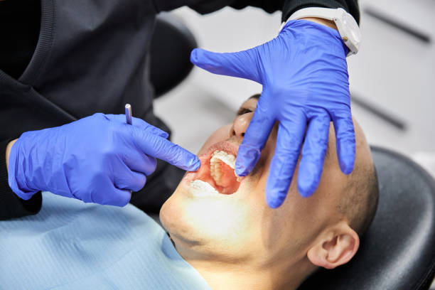 Best Emergency Dentist for Lost Fillings or Crowns in Gleason, TN