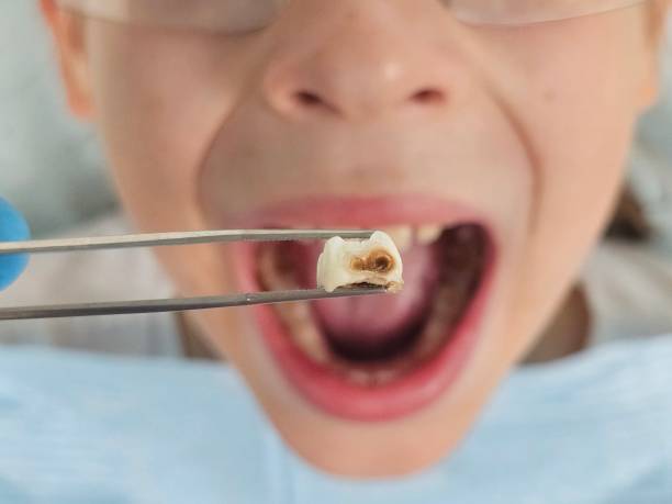 Best Urgent Dental Care for Toothache in Gleason, TN